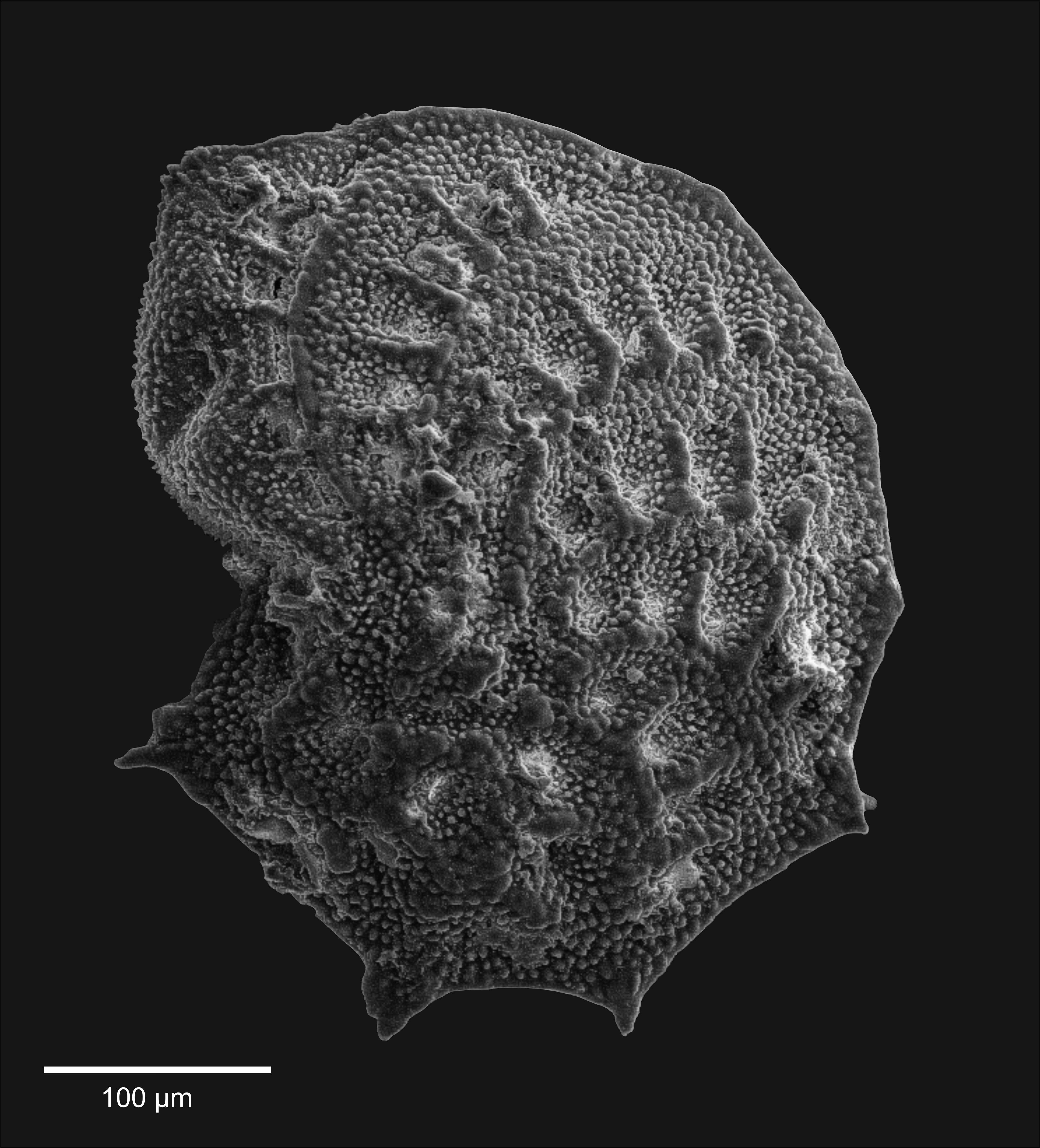 SEM image of benthic foraminifera specimen Elphidium aculeatum from sediment core LK-3 extracted in Lošinj Channel - for more information see the paper Brunović et al. (this Volume)